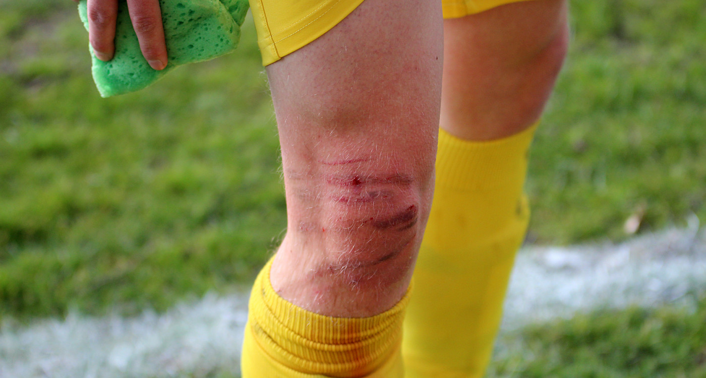 Auch brutale Tritte können unseren MTV nicht stoppen: Gifhorns Oberliga-Fußballer beweisen im Abstiegskampf Nehmer-Qualitäten