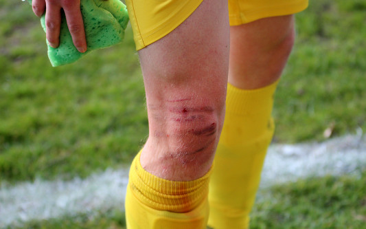 Auch brutale Tritte können unseren MTV nicht stoppen: Gifhorns Oberliga-Fußballer beweisen im Abstiegskampf Nehmer-Qualitäten